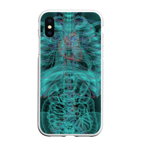 Чехол для iPhone XS Max матовый с принтом рентген человека в Курске, Силикон | Область печати: задняя сторона чехла, без боковых панелей | кости | органы | рентген | человек