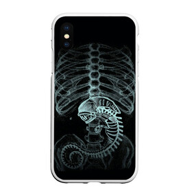 Чехол для iPhone XS Max матовый с принтом Чужой на Рентгене в Курске, Силикон | Область печати: задняя сторона чехла, без боковых панелей | alien | больница | больной | внутренний мир | врач | клиника | кости | пациент | ребра | рентген | скелет | снимок | хищник